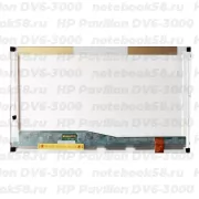 Матрица для ноутбука HP Pavilion DV6-3000 (1366x768 HD) TN, 40pin, Глянцевая