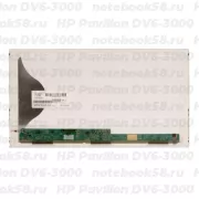 Матрица для ноутбука HP Pavilion DV6-3000 (1366x768 HD) TN, 40pin, Матовая