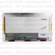 Матрица для ноутбука HP Pavilion DV6-3000 (1366x768 HD) TN, 40pin, Глянцевая